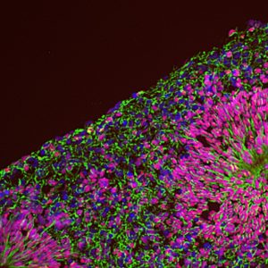 Organoidi cerebrali corticali che mostrano l'organizzazione ventricolare dei progenitori neuronali differenzianti colorati con anticorpi contro il fattore di trascrizione Pax6 (segnale nucleare in rosso), la proteina del filamento Nestina (segnale citoscheletrico in verde) e DAPI (segnale nucleare in blu). Credit: Giuseppe Testa