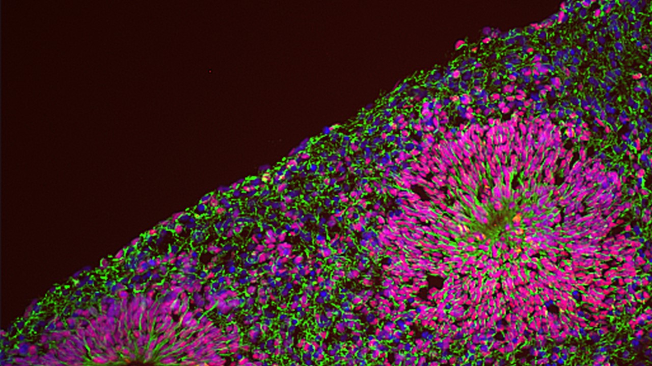 Cortical brain organoids showing the ventricular-like organization of differentiating neuronal progenitors stained with antibodies against the transcription factor Pax6 (nuclear signal in red), the filament protein Nestin (cytoskeletal signal in green) and DAPI (nuclear signal in blue). Credit: Giuseppe Testa