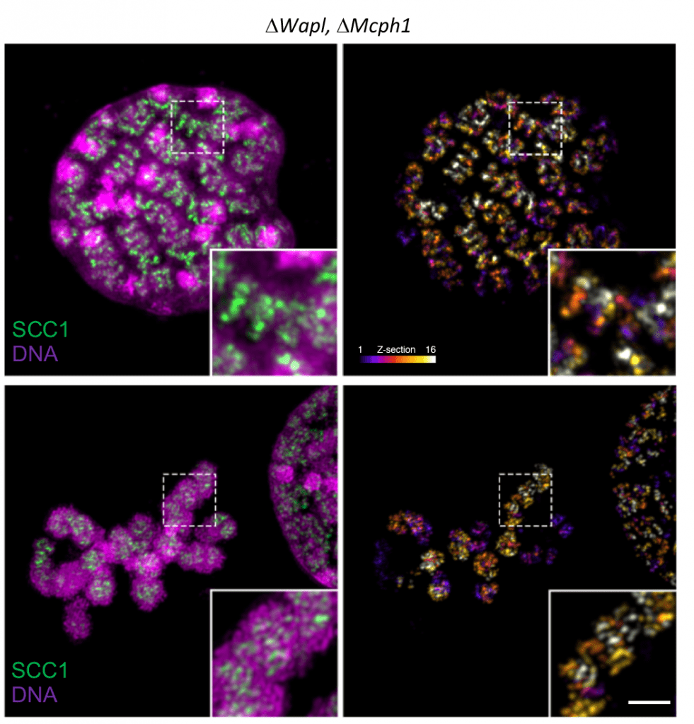 Microcephalin 1 regola la condensazione del DNA cromosomico Biology Diagrams