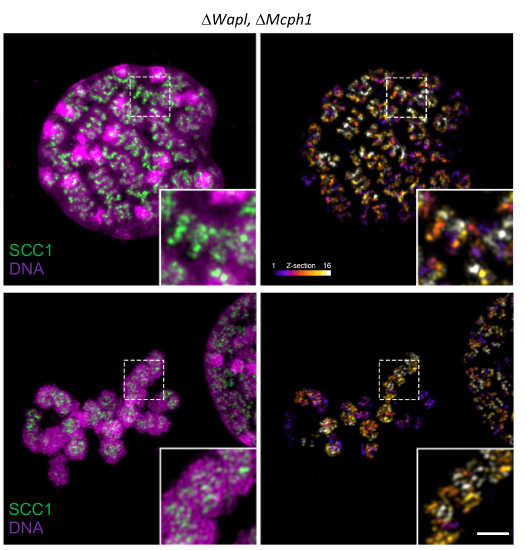 Microcephalin 1 regulates chromosomal DNA condensation