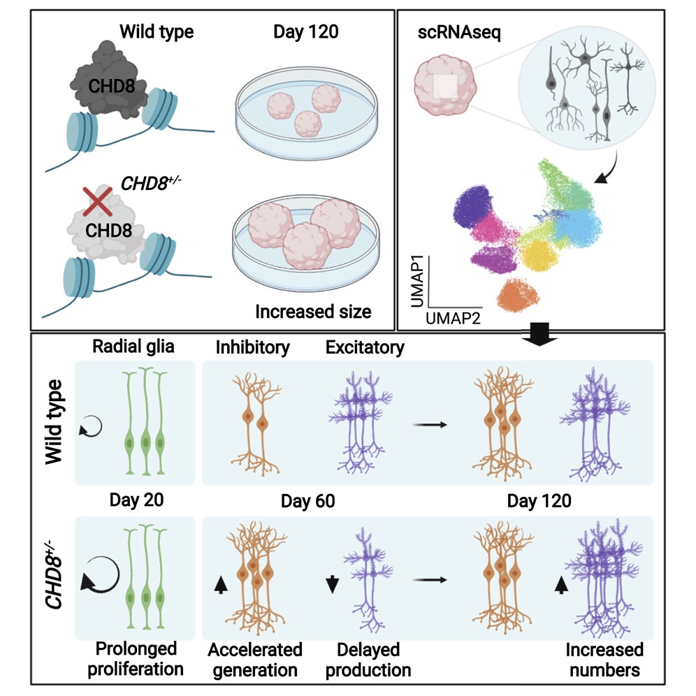 Understanding the developmental origins of autism using brain organoids