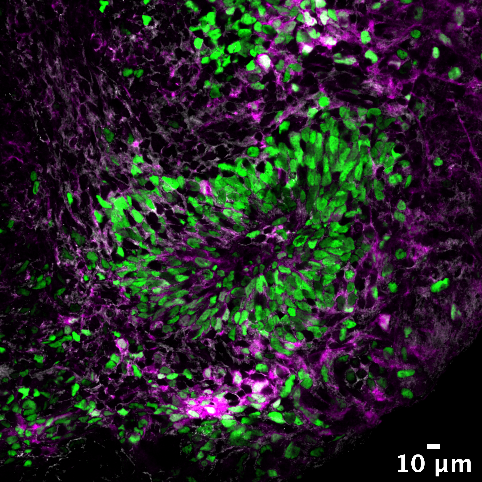 L’evoluzione del cervello umano in provetta