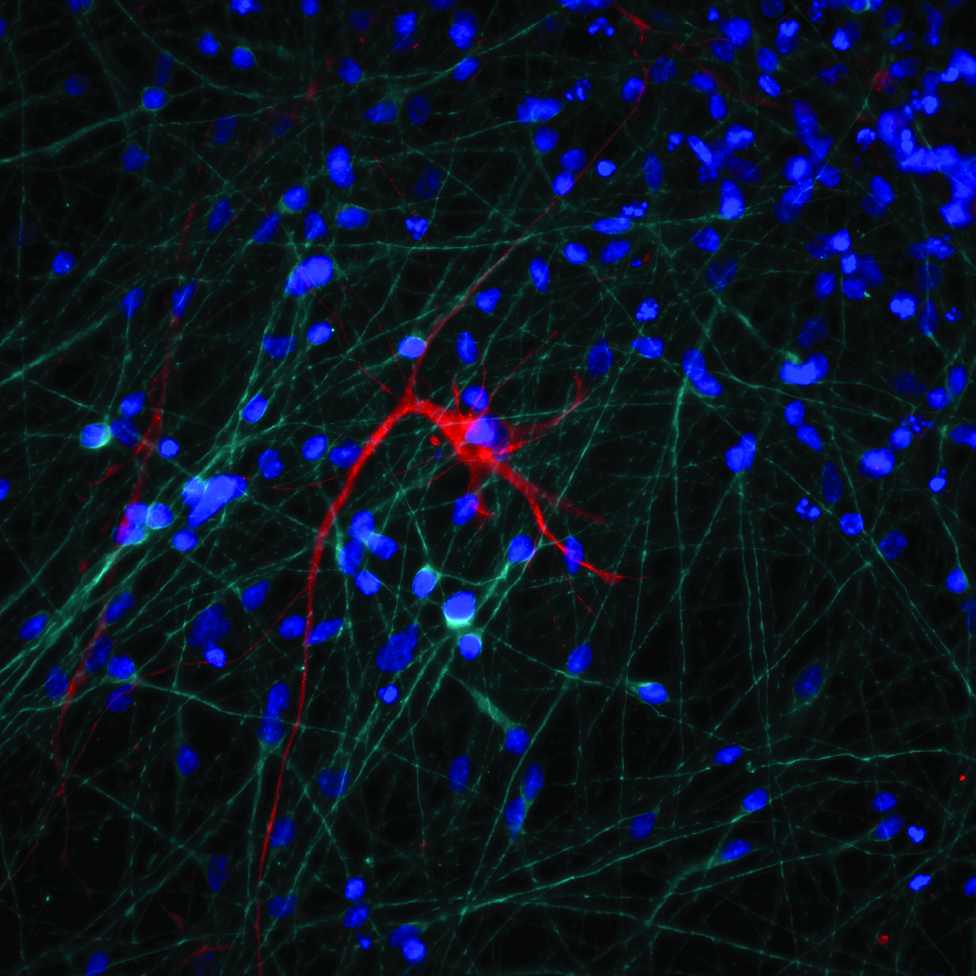 Mappare le rotture spontanee del doppio filamento di DNA nelle cellule neurali