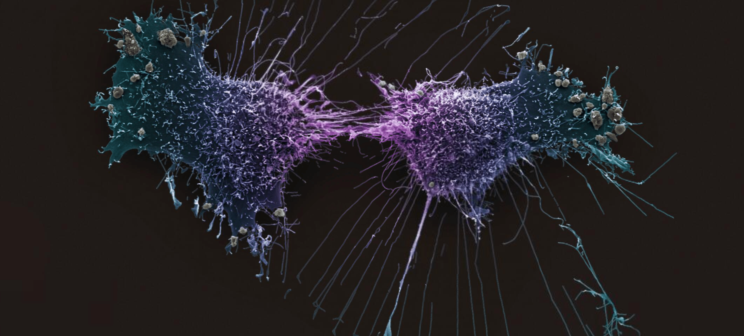 Possono i computer stimare la qualità delle linee cellulari tumorali?