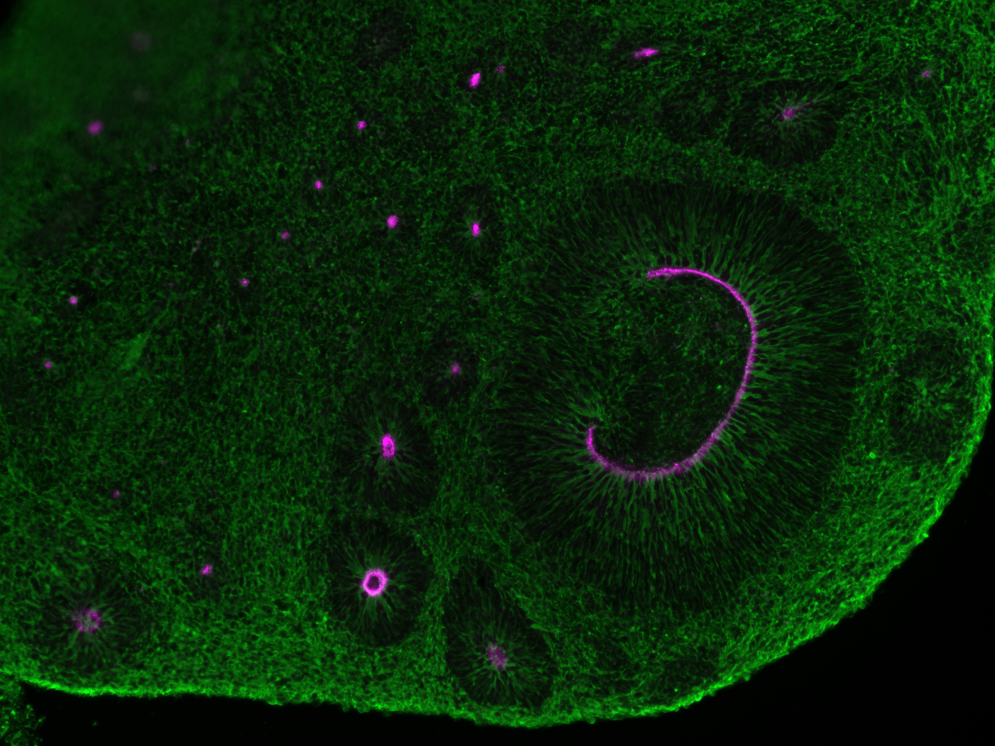 Neural Organoids & Co: when the name matters